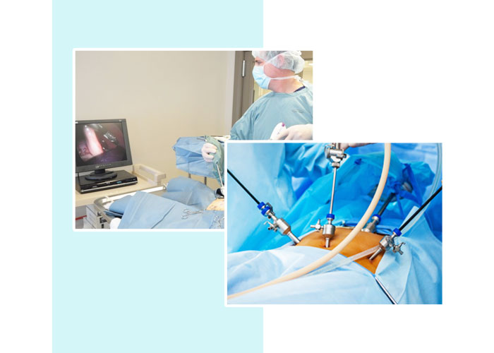 Laparoscopic surgery in Ahmedabad | Best laparoscopic surgeon in Ahmedabad